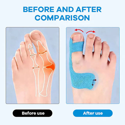 Bunion Support Tape for All-Day Comfort 👣✨